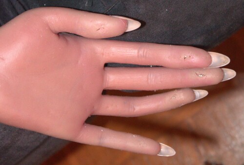 20260723 Smoooth Zelex Hand Reparatur Silikon Kleben (1)